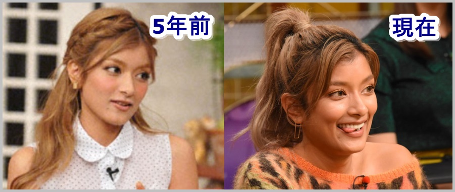 ローラ比較