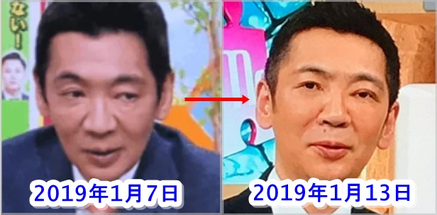 宮根誠司の顔の変化